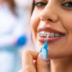 How Dental Clinics Handle Patients With Extreme Gag Reflexes